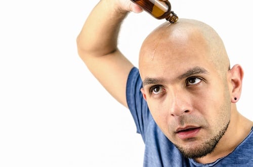 bald man puts oil for hair loss